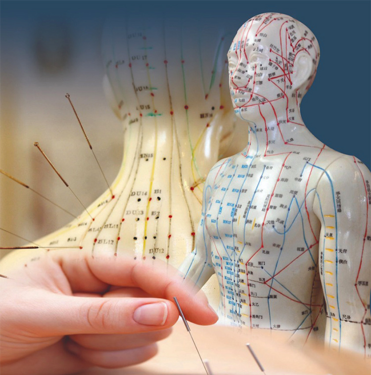 Acupuncture ATAMA