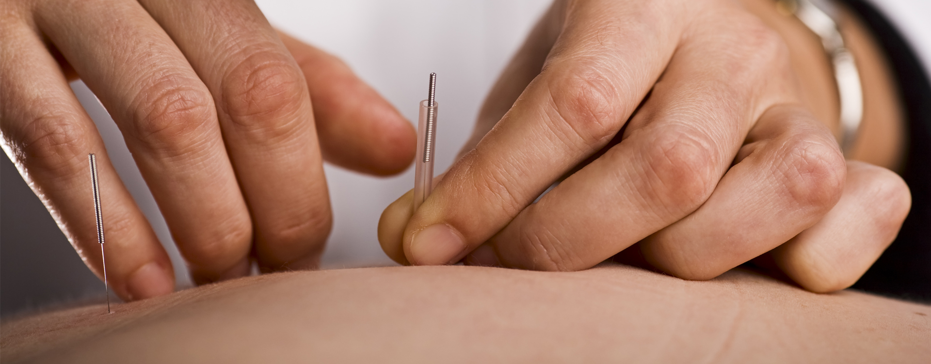 Acupuncture ATAMA