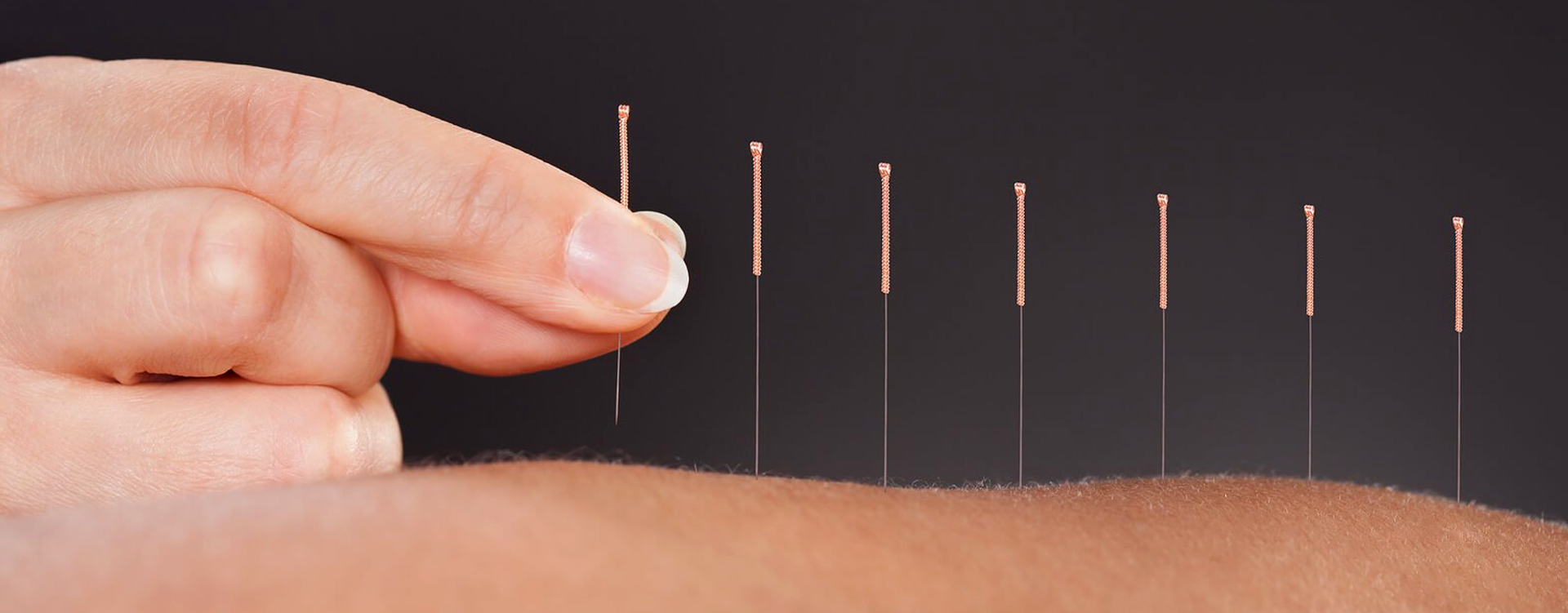 Acupuncture ATAMA